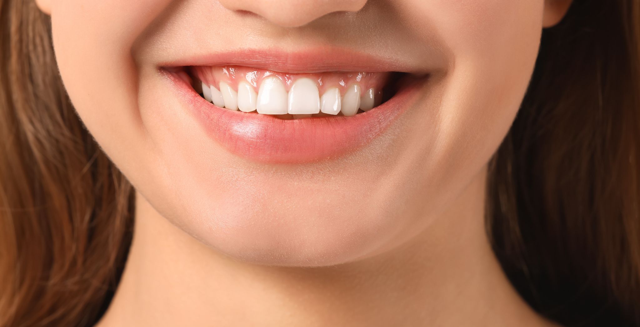 Gummy smile treatment , Gummy smile treatment procedure at dental clinic, Smiling patient after gummy smile correction, Before and after results of gummy smile treatment, Cosmetic dental procedure to reduce gummy smile, Close-up of improved smile after gummy smile treatment,