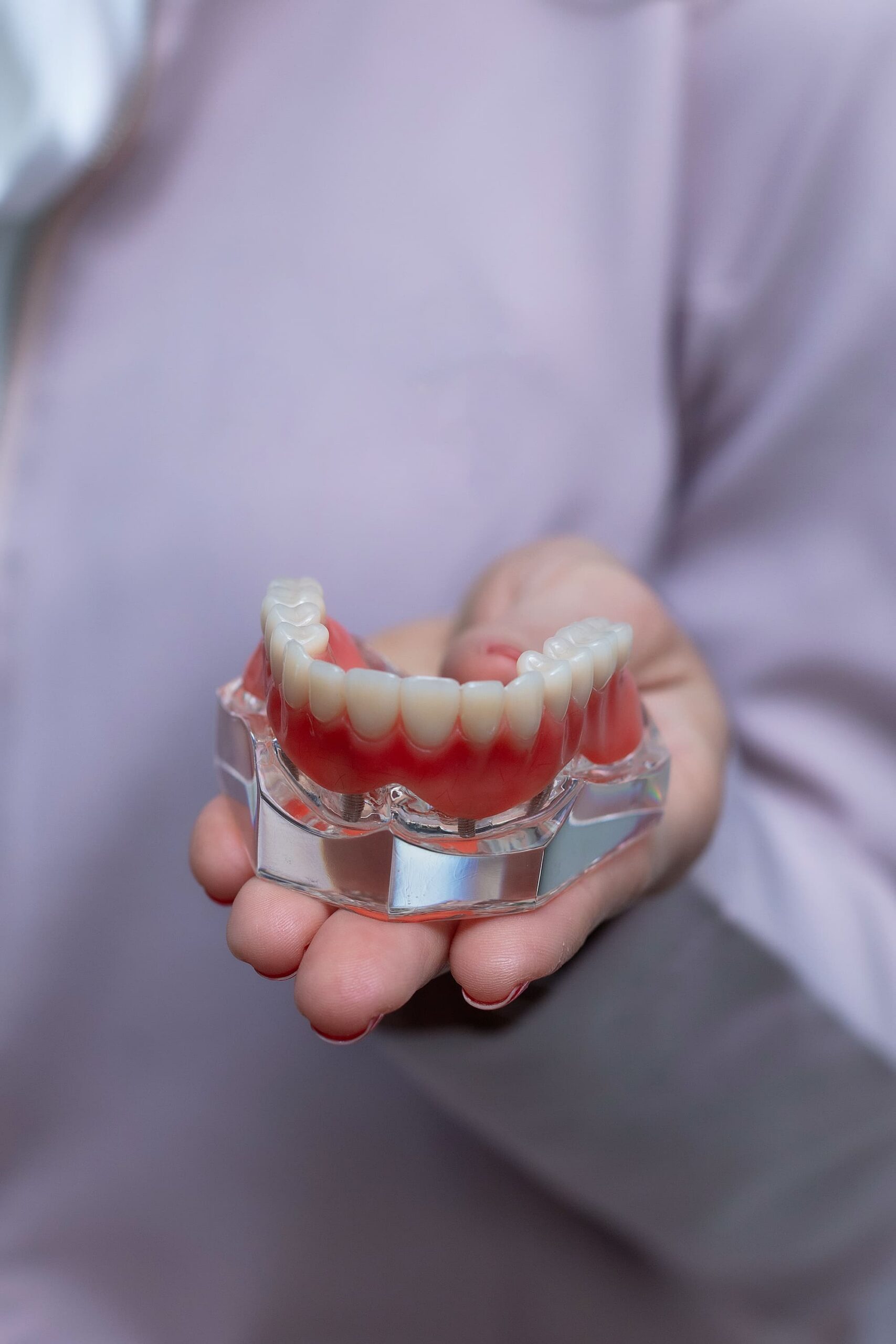 dental implants joondalup 1 scaled